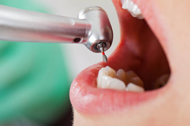 Best Emergency Tooth Extraction in Village Green, NY